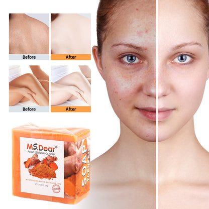 Tumeric Soap Skin Whitening Dark Spots Lightening Acne Brightening Turmeric 100G