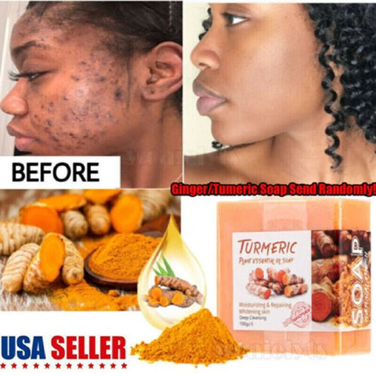 Tumeric Soap Skin Whitening Dark Spots Lightening Acne Brightening Turmeric 100G