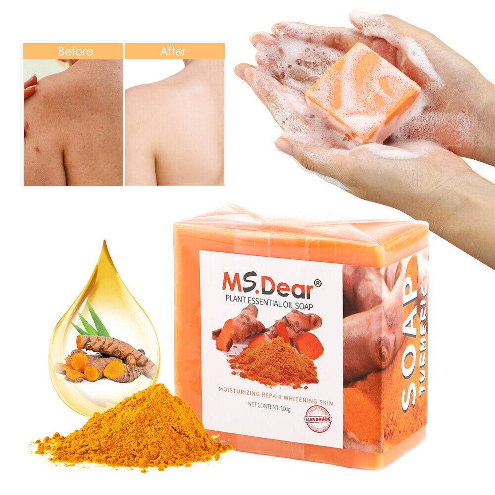 Tumeric Soap Skin Whitening Dark Spots Lightening Acne Brightening Turmeric 100G
