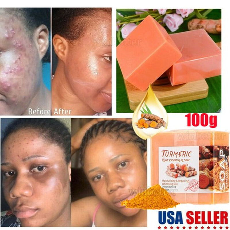 Tumeric Soap Skin Whitening Dark Spots Lightening Acne Brightening Turmeric 100G