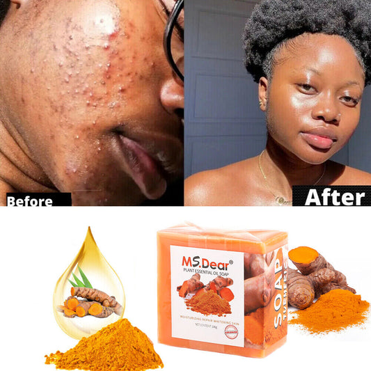 Tumeric Soap Skin Whitening Dark Spots Lightening Acne Brightening Turmeric 100G